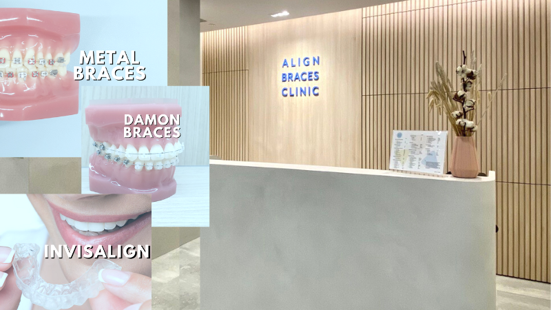 Align Braces Clinic (Parkway Parade)
